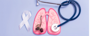 Lung Cancer Image